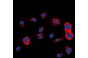 Immunofluorescent analysis of HER2 staining in HepG2 cells. (ErbB2/Her2 抗体)