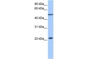 Western Blotting (WB) image for anti-Protein Inhibitor of Activated STAT, 2 (PIAS2) antibody (ABIN2463619) (PIAS2 抗体)