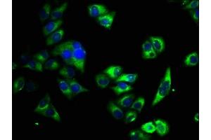 Immunofluorescence staining of Hela cells with ABIN7163520 at 1:33, counter-stained with DAPI. (ATP2B4 抗体  (AA 281-345))