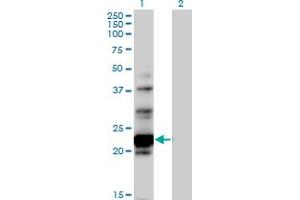Western Blot analysis of NOL6 expression in transfected 293T cell line by NOL6 MaxPab polyclonal antibody. (Nucleolar Protein 6 抗体  (AA 1-200))