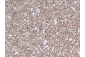 DAB staining on IHC-P; Samples: Human Cerebrum Tissue (CRMP1 抗体  (AA 1-250))