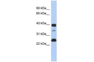 WB Suggested Anti-TMPO Antibody Titration:  0. (Thymopoietin 抗体  (N-Term))