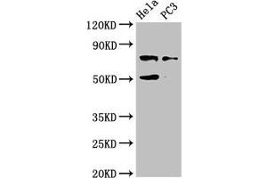 Western Blot Positive WB detected in: Hela whole cell lysate, PC-3 whole cell lysate All lanes: GLB1 antibody at 4 μg/mL Secondary Goat polyclonal to rabbit IgG at 1/50000 dilution Predicted band size: 77, 61, 73 kDa Observed band size: 77 kDa (GLB1 抗体  (AA 317-455))