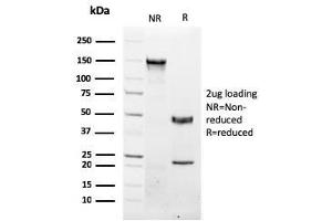 SDS-PAGE Analysis Purified NKX3. (NKX3-1 抗体  (AA 92-224))