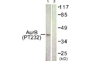 Immunohistochemistry analysis of paraffin-embedded human liver carcinoma tissue using AurB (Phospho-Thr232) antibody. (Aurora Kinase B 抗体  (pThr232))