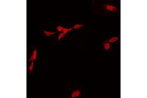 ABIN6268765 staining Hela by IF/ICC. (SOX6 抗体  (N-Term))