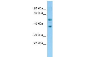 WB Suggested Anti-Fntb Antibody Titration: 1. (FNTB 抗体  (N-Term))