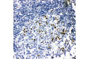 Anti- MUM1 antibody, IHC(P) IHC(P): Human Tonsil Tissue (IRF4 抗体  (AA 272-451))