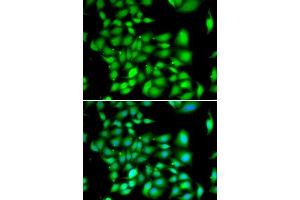 Immunofluorescence analysis of A549 cells using TREX1 antibody. (TREX1 抗体  (AA 1-270))