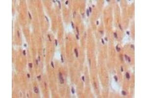 Immunohistochemistry (IHC) image for anti-Brain Natriuretic Peptide (BNP) antibody (ABIN2464019) (BNP 抗体)