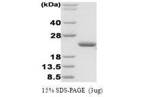 Figure annotation denotes ug of protein loaded and % gel used. (ASPSCR1 蛋白)