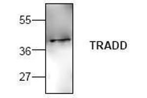 Image no. 1 for anti-TNFRSF1A-Associated Via Death Domain (TRADD) antibody (ABIN127191) (TRADD 抗体)