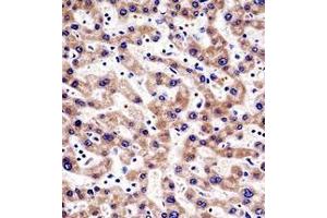 Immunohistochemistry analysis in formalin fixed and paraffin embedded human liver tissue reacted with HTATIP2 Antibody (N-term) followed which was peroxidase conjugated to the secondary antibody and followed by AB staining. (HIV-1 Tat Interactive Protein 2, 30kDa (HTATIP2) (AA 44-74), (N-Term) 抗体)