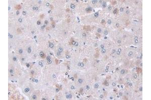 Detection of CAP2 in Human Liver Tissue using Polyclonal Antibody to Adenylyl Cyclase Associated Protein 2 (CAP2) (CAP2 抗体  (AA 317-455))