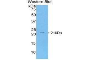Western Blotting (WB) image for anti-TAR DNA Binding Protein (TARDBP) (AA 104-262) antibody (ABIN1860694) (TARDBP 抗体  (AA 104-262))