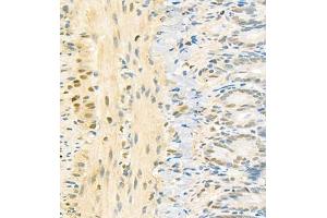Immunohistochemistry (Paraffin-embedded Sections) (IHC (p)) image for anti-Prothymosin, alpha (PTMA) antibody (ABIN7075306)