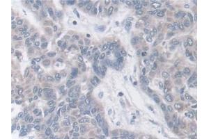 Immunohistochemistry (IHC) image for anti-Breast Cancer Anti-Estrogen Resistance 1 (BCAR1) (AA 1-240) antibody (ABIN7436351)