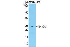 Western Blotting (WB) image for anti-Matrix Metallopeptidase 11 (Stromelysin 3) (MMP11) (AA 302-458) antibody (ABIN1172602) (MMP11 抗体  (AA 302-458))