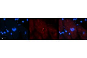 Rabbit Anti-NFATC1 Antibody    Formalin Fixed Paraffin Embedded Tissue: Human Adult heart  Observed Staining: Nuclear, Cytoplasmic Primary Antibody Concentration: 1:100 Secondary Antibody: Donkey anti-Rabbit-Cy2/3 Secondary Antibody Concentration: 1:200 Magnification: 20X Exposure Time: 0.
