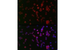 Immunofluorescence analysis of HT-29 cells using NOX1 Rabbit pAb (ABIN6133827, ABIN6144746, ABIN6144748 and ABIN6215916) at dilution of 1:50 (40x lens). (NOX1 抗体  (AA 200-300))