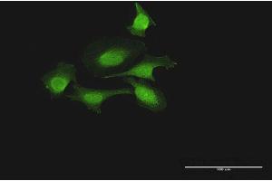 Immunofluorescence of purified MaxPab antibody to FOXJ2 on HeLa cell. (Forkhead Box J2 抗体  (AA 1-574))