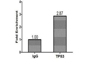 Immunohistochemistry (IHC) image for anti-Tumor Protein P53 (TP53) (AA 2-393) antibody (ABIN7147346)