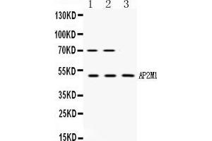 Western blot analysis of AP2M1 expression in rat kidney extract ( Lane 1), NIH3T3 whole cell lysates ( Lane 2) and MCF-7 whole cell lysates ( Lane 3). (AP2M1 抗体  (C-Term))