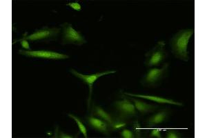 Immunofluorescence of purified MaxPab antibody to S100A7 on HeLa cell. (S100A7 抗体  (AA 1-101))