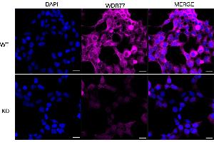 anti-WD Repeat Domain 77 (WDR77) antibody