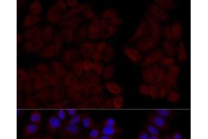 Immunofluorescence analysis of HeLa cells using CALM1 Polyclonal Antibody at dilution of 1:100 (40x lens). (Calmodulin 1 抗体)