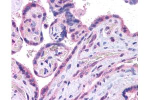 Immunohistochemistry (IHC) image for anti-V-Maf Musculoaponeurotic Fibrosarcoma Oncogene Homolog (Avian) (MAF) (N-Term) antibody (ABIN501710) (MAF 抗体  (N-Term))