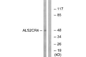 Western blot analysis of extracts from Jurkat cells, using ALS2CR4 antibody. (TMEM237 抗体)