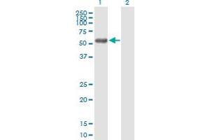 Western Blot analysis of RCBTB2 expression in transfected 293T cell line by RCBTB2 MaxPab polyclonal antibody.