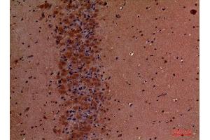 Immunohistochemistry (IHC) analysis of paraffin-embedded Mouse Brain, antibody was diluted at 1:100. (TLN1 抗体  (Internal Region))