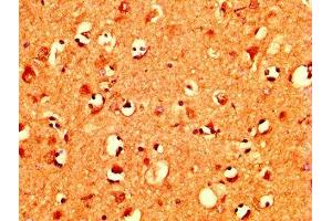 IHC image of ABIN7160478 diluted at 1:400 and staining in paraffin-embedded human brain tissue performed on a Leica BondTM system. (MZF1 抗体  (AA 186-354))