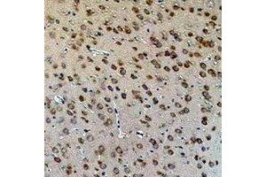 Immunohistochemical analysis of Aquaporin 4 staining in rat brain  formalin fixed paraffin embedded tissue section. (Aquaporin 4 抗体)