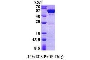 Figure annotation denotes ug of protein loaded and % gel used. (GDA 蛋白)