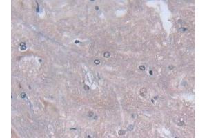 Detection of CYGB in Rat Spinal cord Tissue using Polyclonal Antibody to Cytoglobin (CYGB) (CYGB 抗体  (AA 1-190))