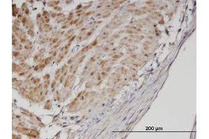Immunoperoxidase of monoclonal antibody to TPM3 on formalin-fixed paraffin-embedded human smooth muscle. (TPM3 抗体  (AA 1-248))