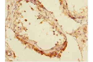 Immunohistochemistry of paraffin-embedded human testis tissue using ABIN7165192 at dilution of 1:100 (CBFA2T2 抗体  (AA 325-604))