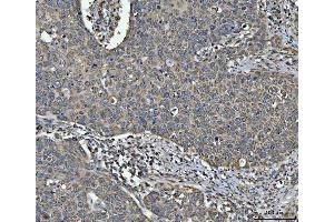 IHC analysis of NDUFV2 using anti-NDUFV2 antibody (ABIN7599154). (NDUFV2 抗体  (AA 1-249))