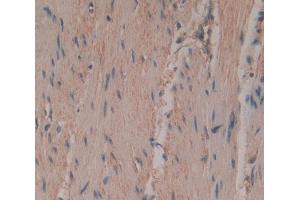 Immunohistochemistry (IHC) image for anti-Prostaglandin I2 (Prostacyclin) Synthase (PTGIS) (AA 1-500) antibody (ABIN1870078)
