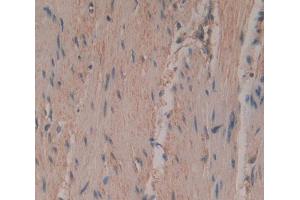 Used in DAB staining on fromalin fixed paraffin- embedded rectum skeletal muscle tissue (PTGIS 抗体  (AA 1-500))