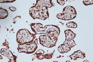 Immunohistochemistry of paraffin-embedded human placenta using RanG Rabbit mAb (ABIN7269846) at dilution of 1:100 (40x lens). (RANGAP1 抗体)