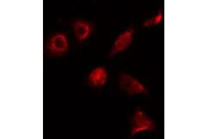 ABIN6274131 staining 293 cells by IF/ICC. (ALX3 抗体  (Internal Region))