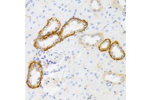 Immunohistochemistry of paraffin-embedded rat kidney using MYO5A antibody (ABIN6003562) at dilution of 1/100 (40x lens). (MYO5A 抗体)