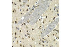 Immunohistochemistry of paraffin-embedded mouse brain using MAX antibody at dilution of 1:200 (400x lens). (MAX 抗体)