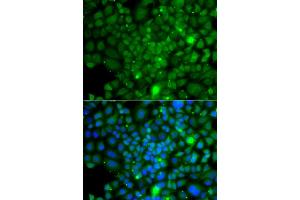 Immunofluorescence analysis of A549 cells using RRAGA antibody (ABIN5974959). (RRAGA 抗体)