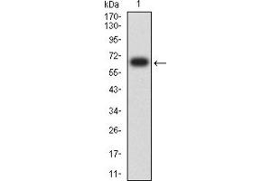 Western blot analysis using KRT13 mAb against human KRT13 (AA: 104-458) recombinant protein. (Cytokeratin 13 抗体  (AA 104-458))