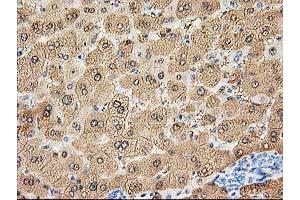 Image no. 1 for anti-Aldolase B, Fructose-Bisphosphate (ALDOB) antibody (ABIN1496606) (ALDOB 抗体)